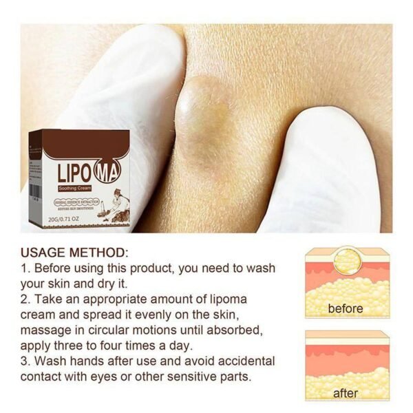 CREMA PARA NUDOS - Imagen 2
