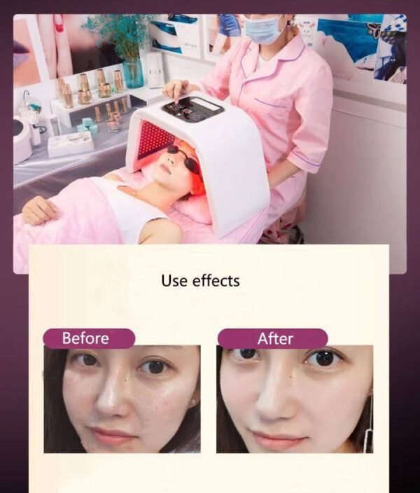 MAQUINA DE MASCARILLA FACIAL PDT LED DE 4 COLORES - Imagen 3